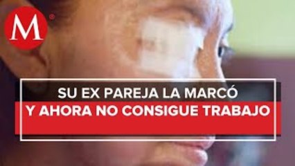 Covid-19 complica la situacion de Esmeralda Millan, victima con acido