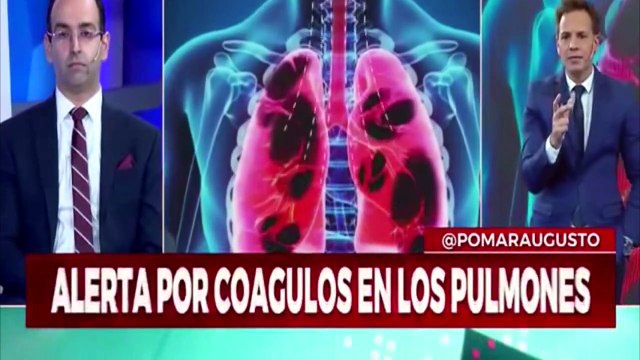 Coronavirus - Síndrome Inflamatorio Revelan Autopsias