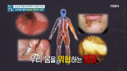 ♨몸속에서 화르륵♨ 목숨을 위협하는 OO…!