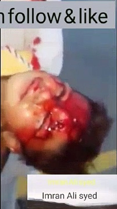 Dangerous excident in Pakistan