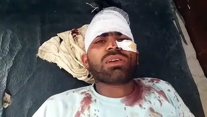 दबंगों ने युवक को घर में घुस कर जमकर पीटा, हालात गम्भीर