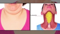 How To Get Rid Of Double Chin | गले की चर्बी घटाने का देसी इलाज