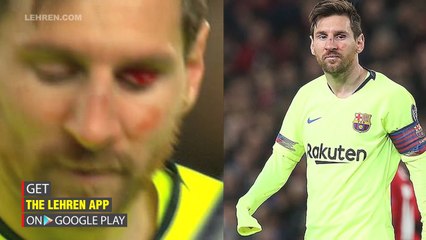 Chris Smalling Leaves Lionel Messi With A Bloody Nose