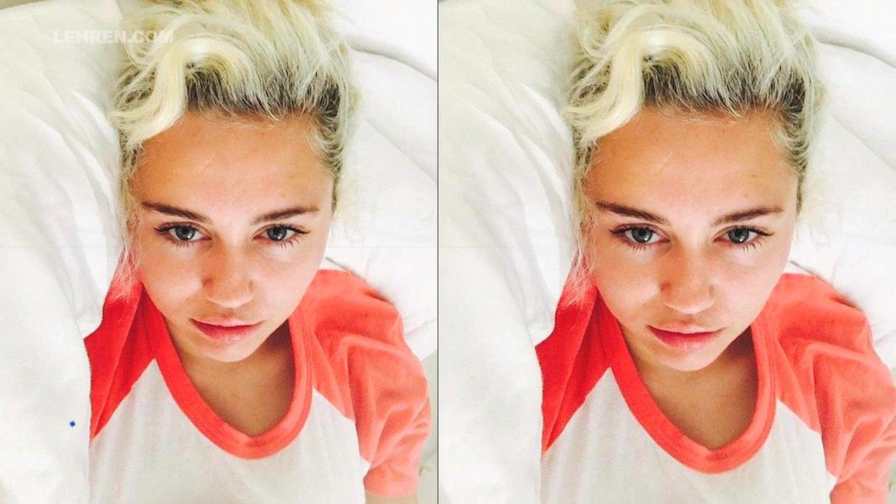 Is Miley Cyrus risking voice change after vocal cord surgery?