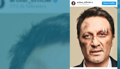 L'animateur Arthur s’affiche défiguré sur Instagram