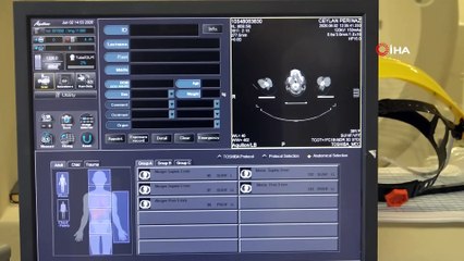 Türkiye’de yemek borusu kanseri en çok Van ve Erzurum’da görülüyor