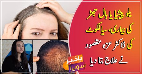 How to get rid of hair fall problem