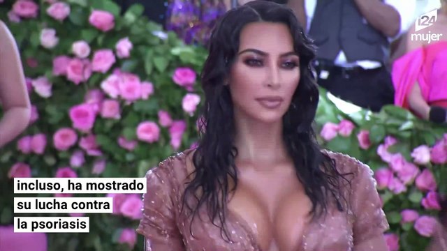 Famosas que presumen con orgullo las 'imperfecciones' de su cuerpo