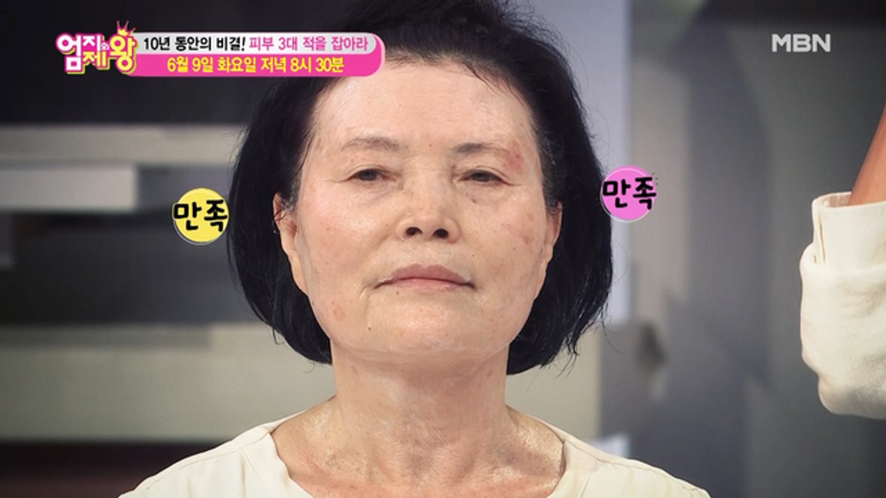 엄지의 제왕 386회 [10년 동안의 비결! 피부 3대 적을 잡아라]