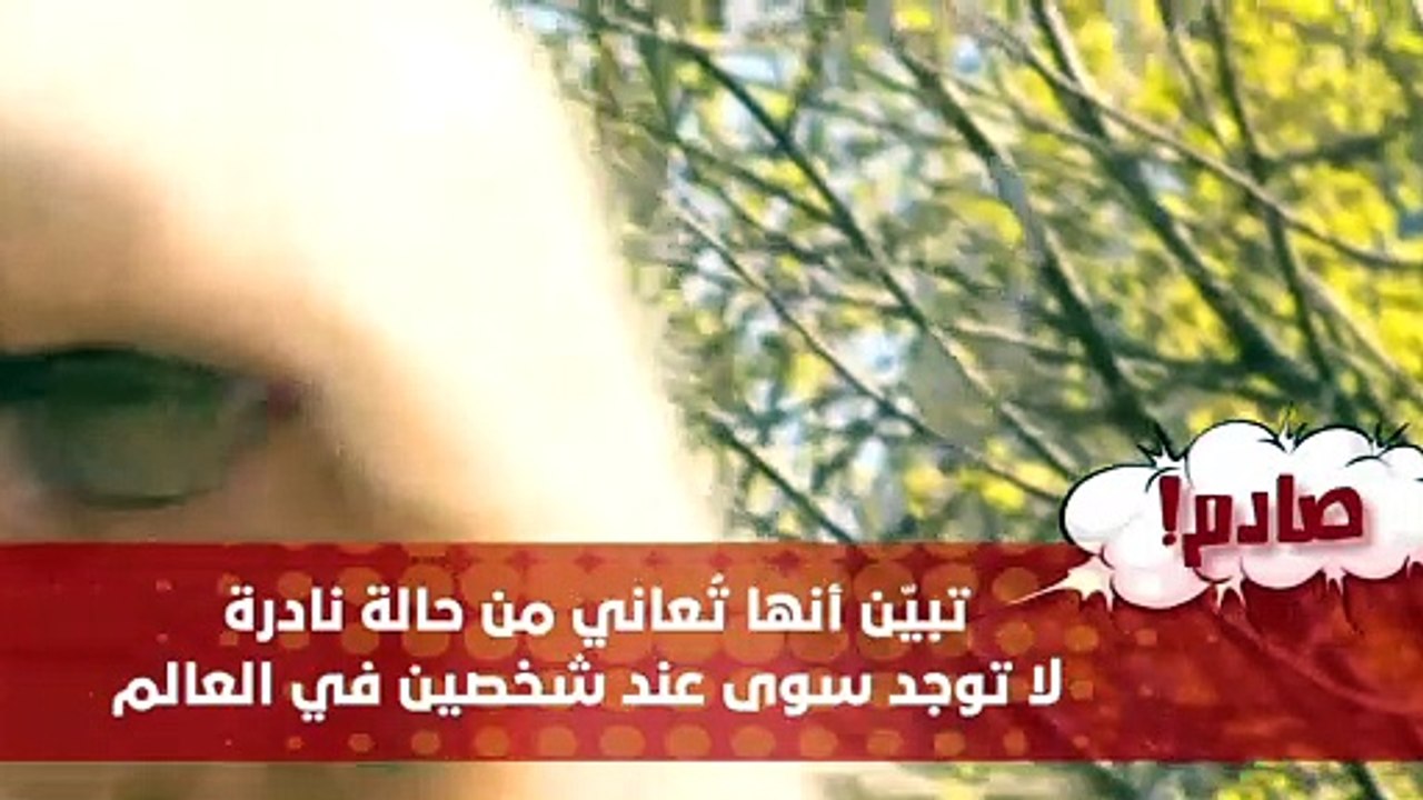 قصة أغرب امرأة في العالم... لا تشعر بالألم نهائياً