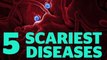 5 Scariest Diseases Outbreaks of the Past Century - Top 5