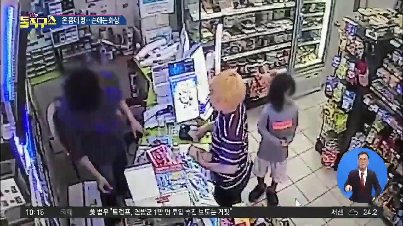 [핫플]아홉 살 아이 온몸에 멍…머리엔 피, 손엔 화상