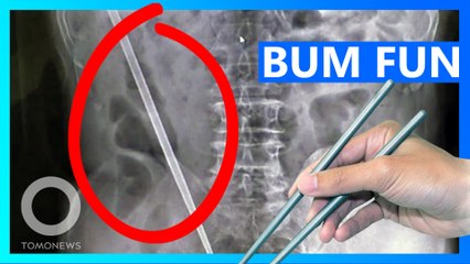 YOU IDIOT: Chinese Man Shoves Chopstick up his Bum