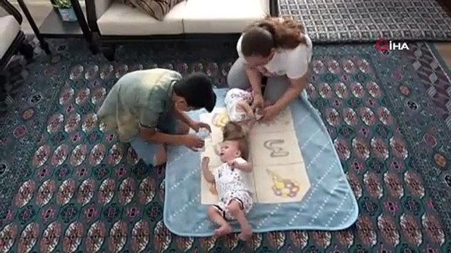 Cumhurbaşkanı Erdoğan tedavilerini duyurmuştu; kafası yapışık siyam ikizleri ayrıldı