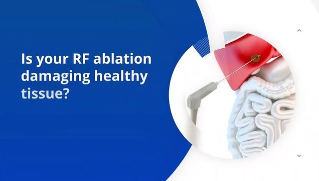 Fiber Optic Temperature Sensors for RF Ablation methods