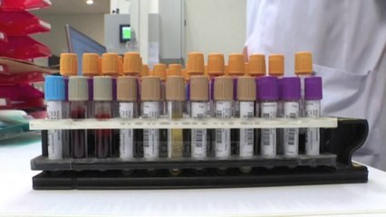 Top News - Mbijetesa e virusit/ Nga 3 sekonda në dy minuta