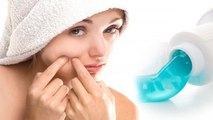 Toothpaste से मिलेंगे Skin को ये जबरदस्त फायदे । Skin Benefits Of Toothpaste । Boldsky