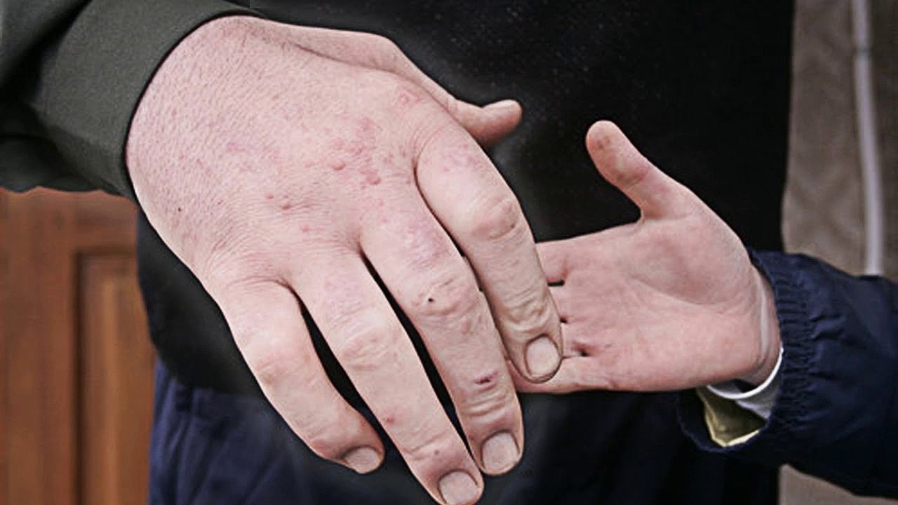 10 People Who Have The Biggest Body Parts