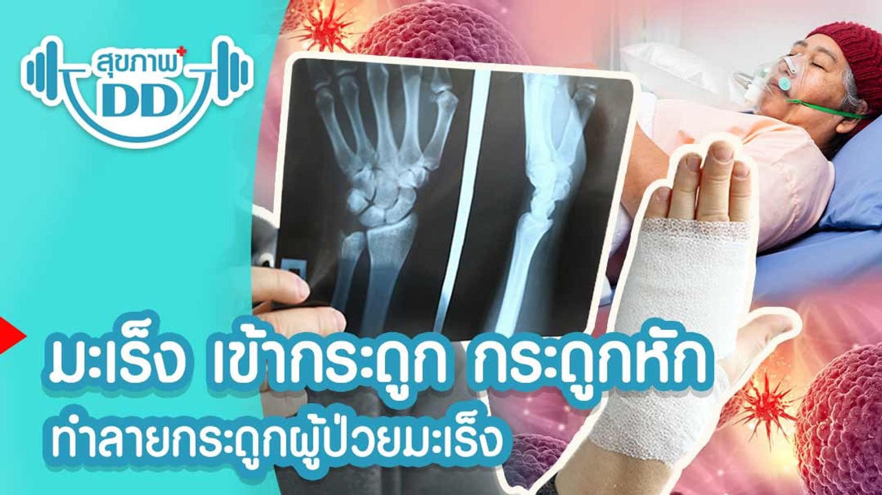 ไขข้อข้องใจ มะเร็งตับ เหตุใดถึงรู้ว่าเป็นมะเร็ง หลังจากกระดูกหัก  เคสเดียวกับ ตั้ว ศรัณยู
