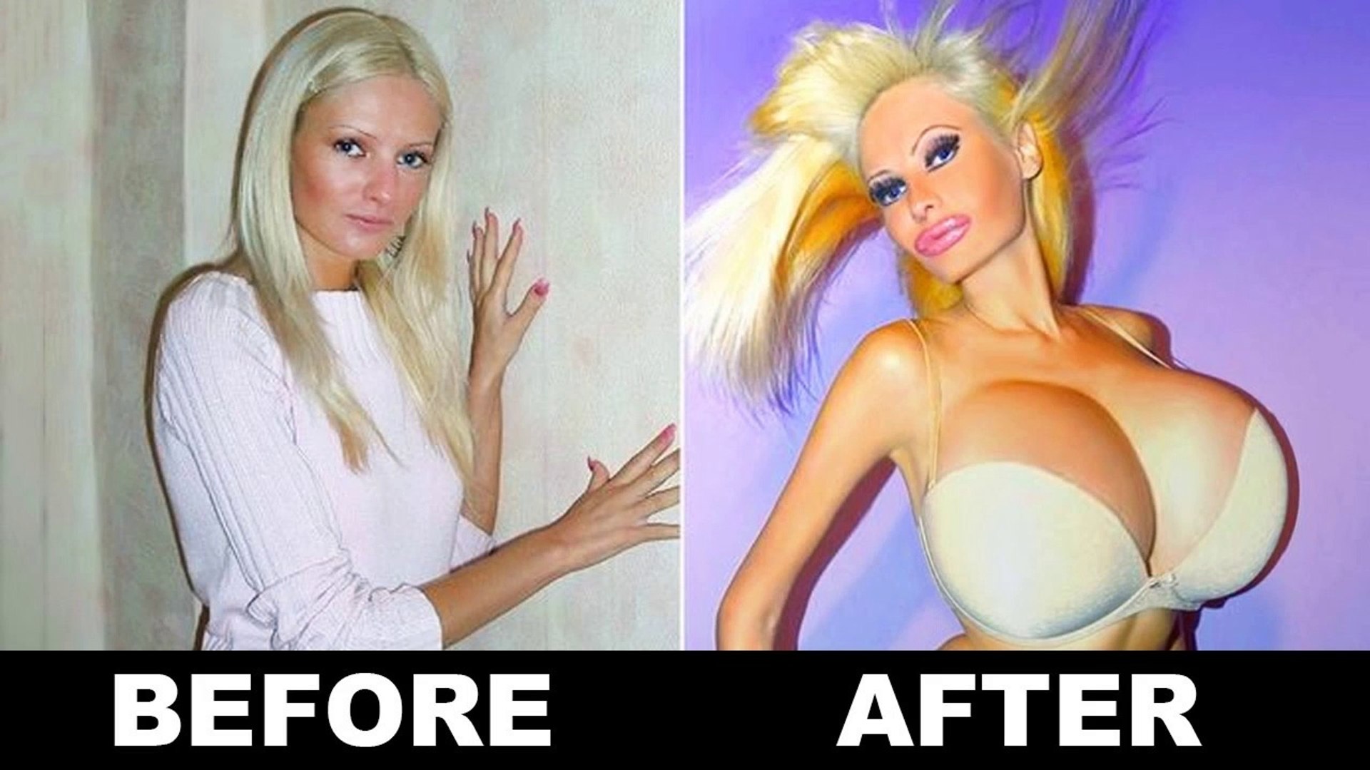 ⁣10 Extreme Plastic Surgery Transformations