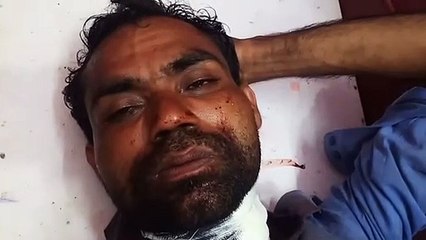 सौतेली माँ सहित तीन अन्य पर पिता की गर्दन काटने का आरोप