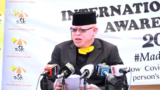 World Marks International Albinism Awareness Day