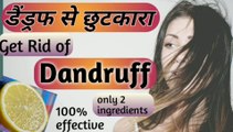 Dandruff,  dandruff  remove remedy, dandruff treatment at home, Rusi hatane ke upaye, Rusi ghr par kese hataye, Lemon  treatment  for dandruff,  रुसी हटाने  का घरेलु उपाय