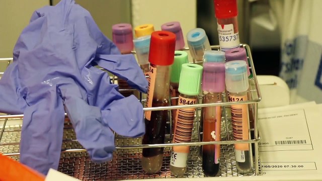 Sanidad informa de 26 muertes en una semana y los contagios bajan a 48 en el último día