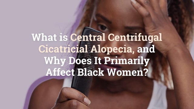 What is Central Centrifugal Cicatricial Alopecia, and Why Does It Primarily Affect Black W