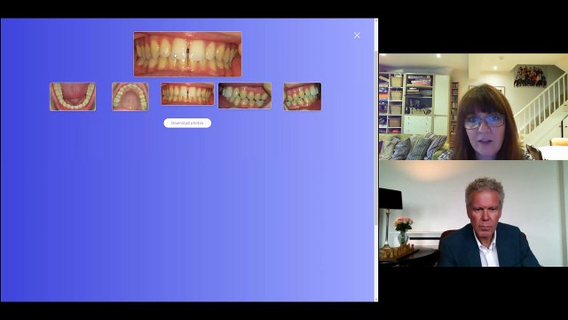 Claire Nightingale ORTHODONTICS THE PATIENT's JOURNEY AI results Vs photos 18 06 2020