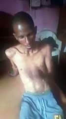 Ibrahima Barry, malade, a besoin de votre aide pour recouvrer sa santé