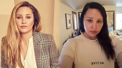 Amanda Bynes To Undergo Treatment For Stress And Anxiety