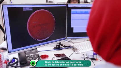 Rede de laboratórios quer fazer 100 mil testes de covid-19 por mês