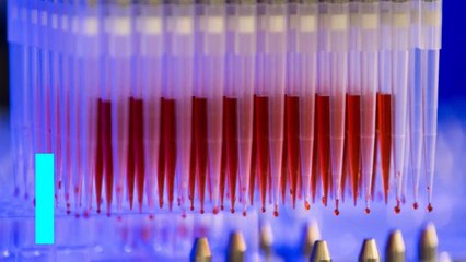 Moderna COVID-19 vaccine appears to clear safety hurdle in mouse study