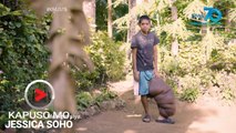 Kapuso Mo, Jessica Soho: Kaliwang binti ng 24-anyos mula Quezon, bakit patuloy na lumolobo?