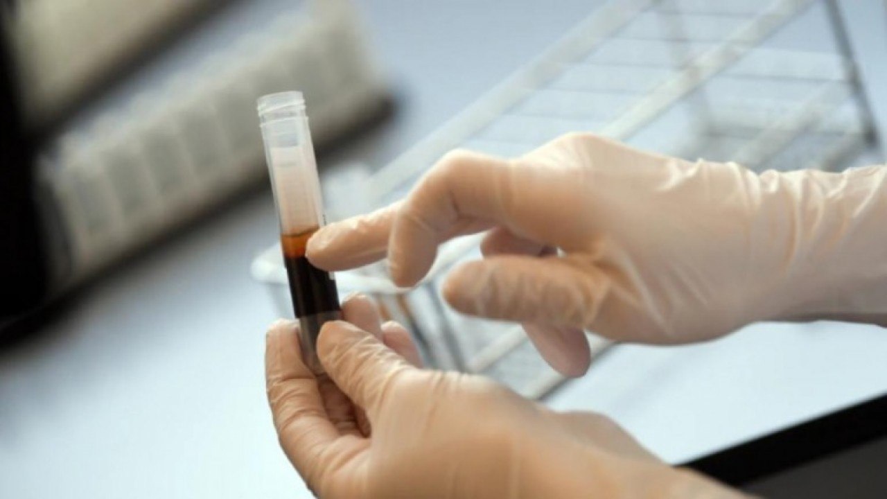 Delhi starts antigen-based coronavirus testing