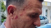 Vlorë, dhunohet fizikisht avokati Kujtim Çakrani: Ka të bëjë me çështjen e rrëmbimit të një personi