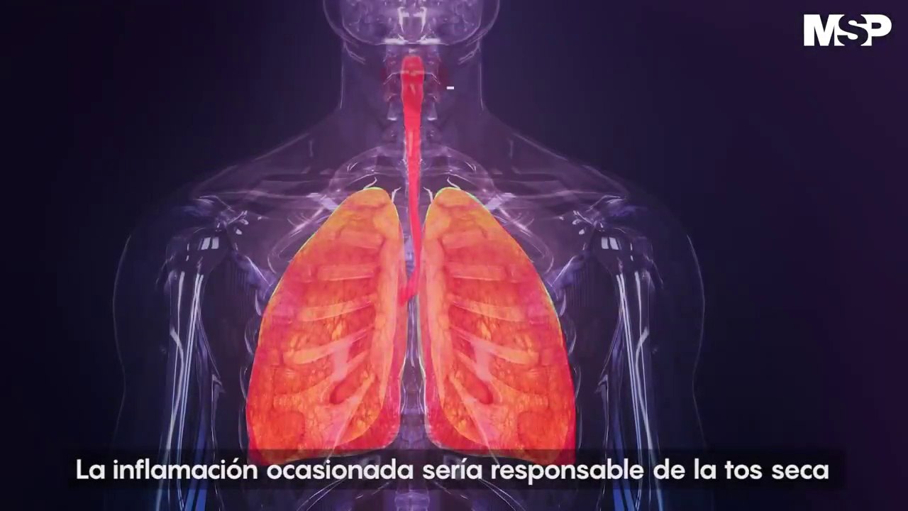 Síntomas del coronavirus - Así ataca el coronavirus en el cuerpo humano