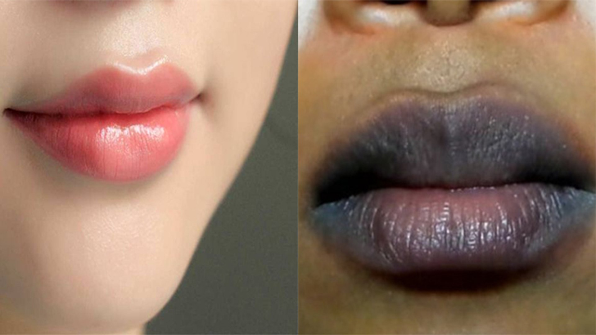 Smoking करने से काले हो गए हैं Lips, तो करें ये उपाय मिलेगी गुलाबी रंगत |  Pink Lips | Boldsky - video Dailymotion