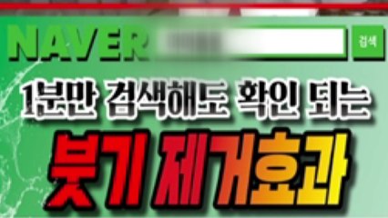 비공개 SNS '친구 맺기' 활용한 허위·과대광고 적발 / YTN