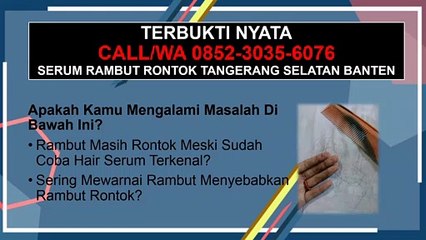 FREE ONGKIR SE-INDONESIA, CALL/WA 0852-3035-6076, Serum Penumbuh Rambut Tangerang Selatan Banten