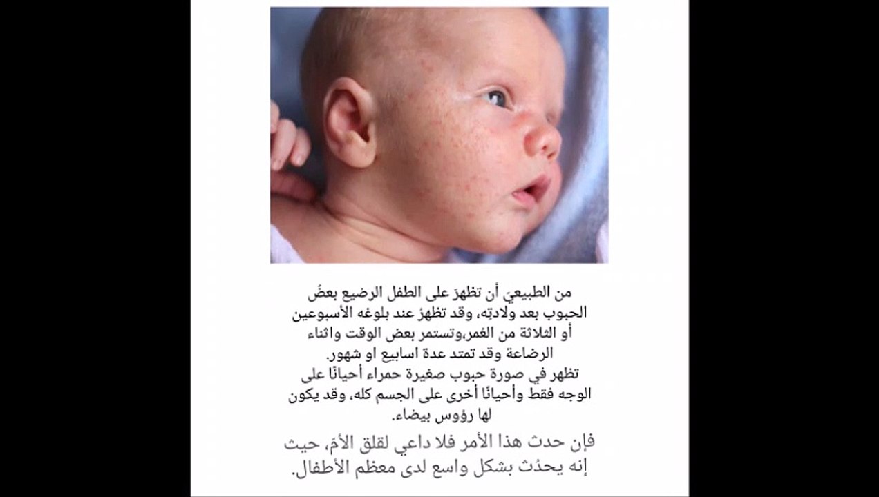 اسباب ظهور حبوب في وجه الاظفال الرضع وظرق علاجها | Dr Gild |