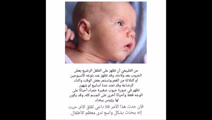 اسباب ظهور حبوب في وجه الاظفال الرضع وظرق علاجها | Dr Gild |