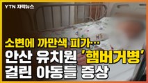 [자막뉴스] 소변에 까만 피가...'햄버거병' 걸린 안산 유치원 아동 증상 / YTN