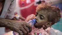 اليمن.. عدد الأطفال الذين يعانون من سوء التغذية في ارتفاع مستمر