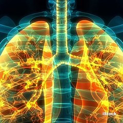 Prepara tu tinte rojo natural y luce espectacular