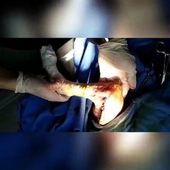 Köpek kemik kırığı ameliyatı.