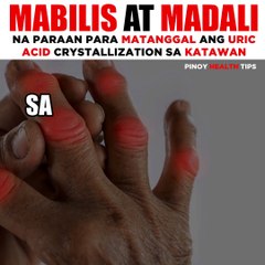 MABILIS AT MADALI NA PARAAN PARA MATANGGAL ANG URIC ACID CRYSTALLIZATION SA KATAWAN