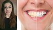 दांतो से पीलापन से दूर करने के लिए RaveenaTandon के Tips को करें Follow । Teeth Whitenting ।Boldsky