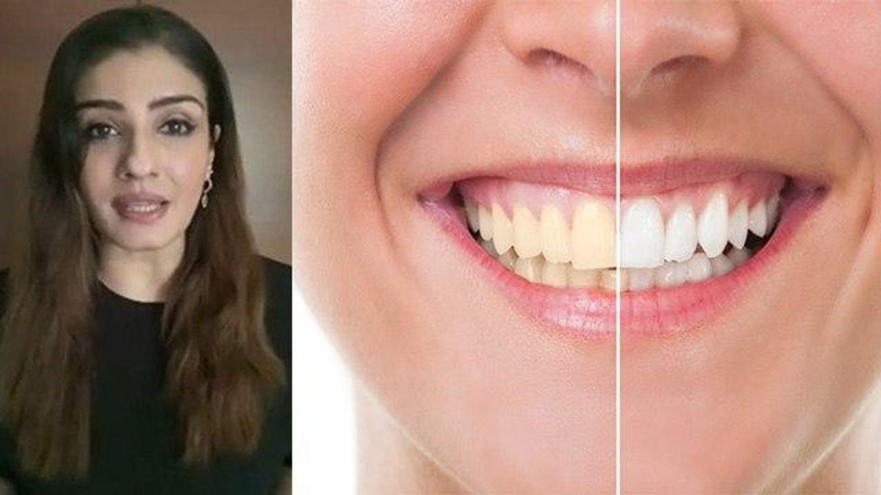 दांतो से पीलापन से दूर करने के लिए RaveenaTandon के Tips को करें Follow । Teeth Whitenting ।Boldsky